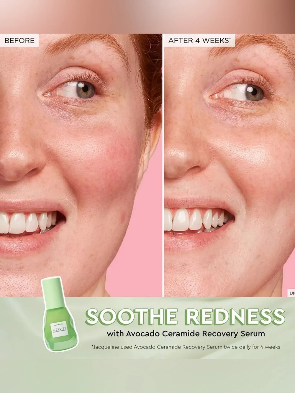 GLOW RECIPE AVOCADO SOOTHING SKIN BARRIER SERUM WITH CERAMIDES